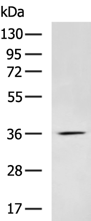 Rabbit Polyclonal Antibody to CASP7