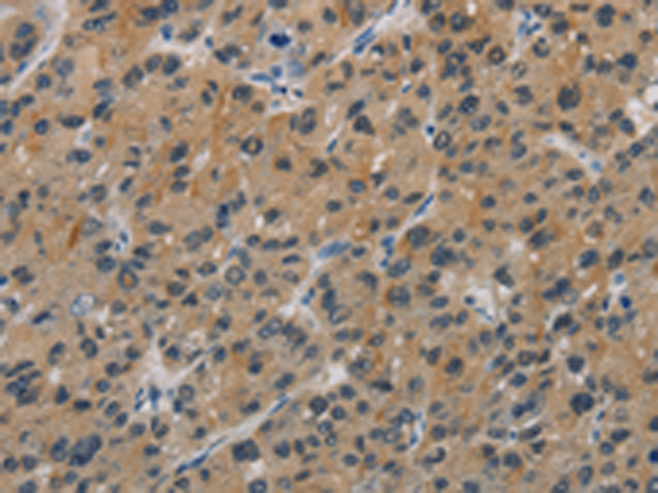 Rabbit Polyclonal Antibody to CASP9