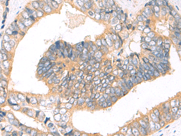 Rabbit Polyclonal Antibody to STAT5B