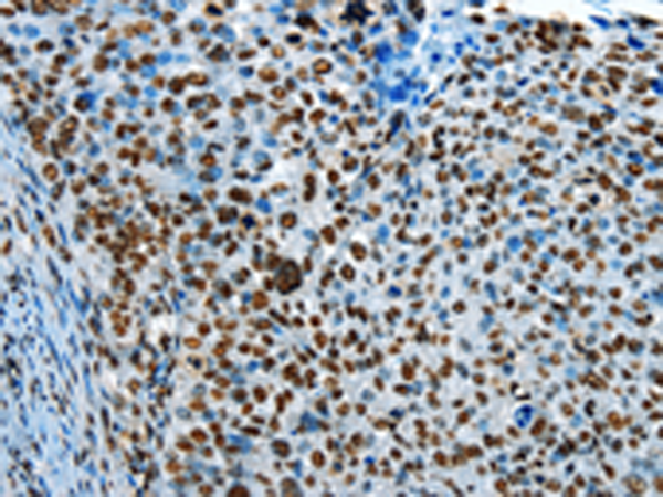 Rabbit Polyclonal Antibody to CREB1