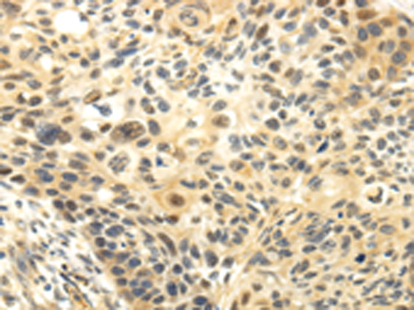 Rabbit Polyclonal Antibody to CDKN1A
