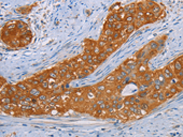 Rabbit Polyclonal Antibody to MMP1