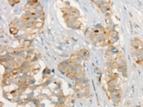 Rabbit Polyclonal Antibody to MMP9