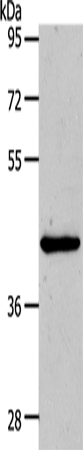 Rabbit Polyclonal Antibody to MMP13