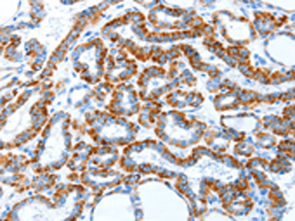 Rabbit Polyclonal Antibody to TLR2