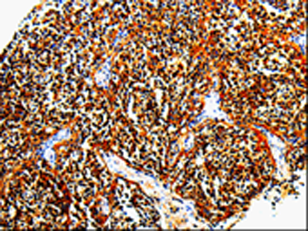 Rabbit Polyclonal Antibody to TLR7