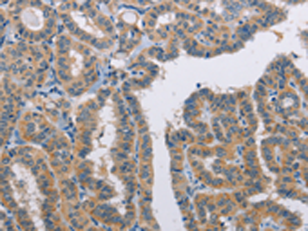 Rabbit Polyclonal Antibody to TLR8