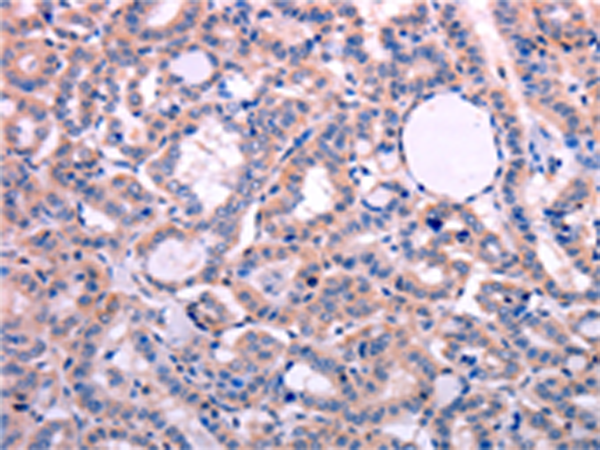 Rabbit Polyclonal Antibody to LEP