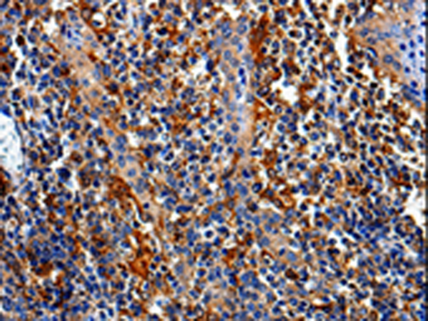 Rabbit Polyclonal Antibody to COX16