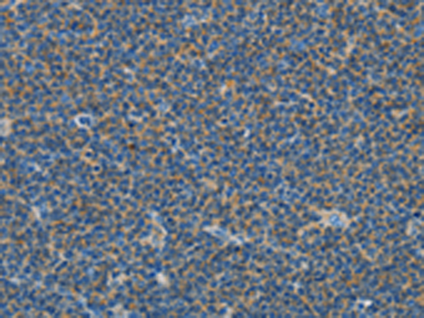 Rabbit Polyclonal Antibody to COX7B2