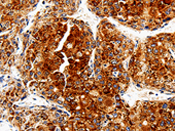 Rabbit Polyclonal Antibody to COX19
