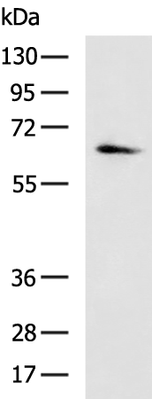 Rabbit Polyclonal Antibody to SMAD4