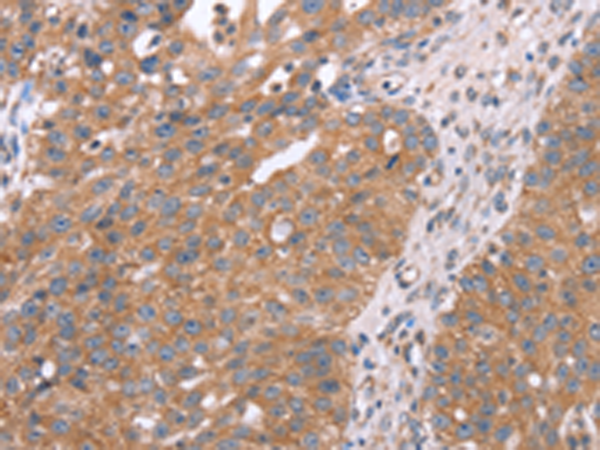 Rabbit Polyclonal Antibody to APP