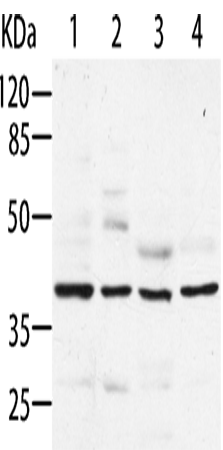 Rabbit Polyclonal Antibody to AIMP2