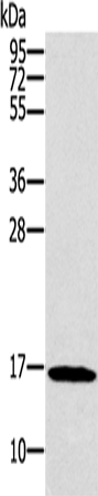 Rabbit Polyclonal Antibody to SNCG