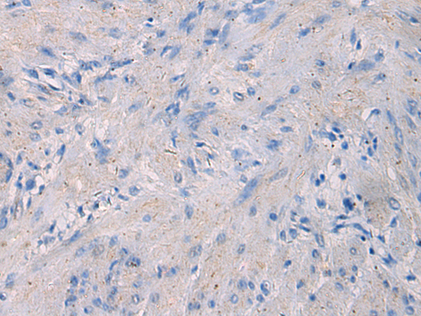 Rabbit Polyclonal Antibody to NFKB1