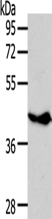 Rabbit Polyclonal Antibody to NFKBIE