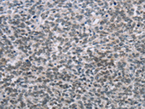 Rabbit Polyclonal Antibody to TONSL