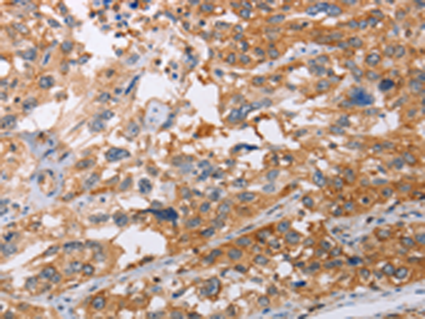 Rabbit Polyclonal Antibody to NLRP3