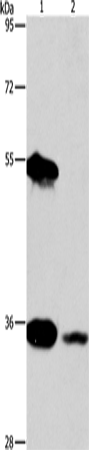 Rabbit Polyclonal Antibody to BAG1