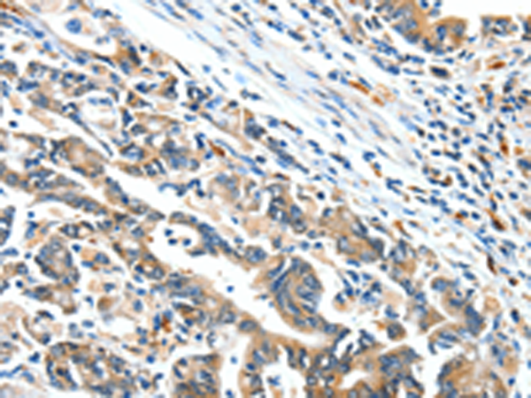 Rabbit Polyclonal Antibody to BCL2L2