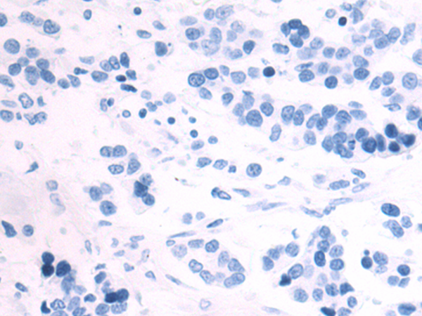 Rabbit Polyclonal Antibody to BCL2L12