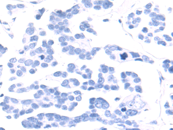 Rabbit Polyclonal Antibody to BNIP1