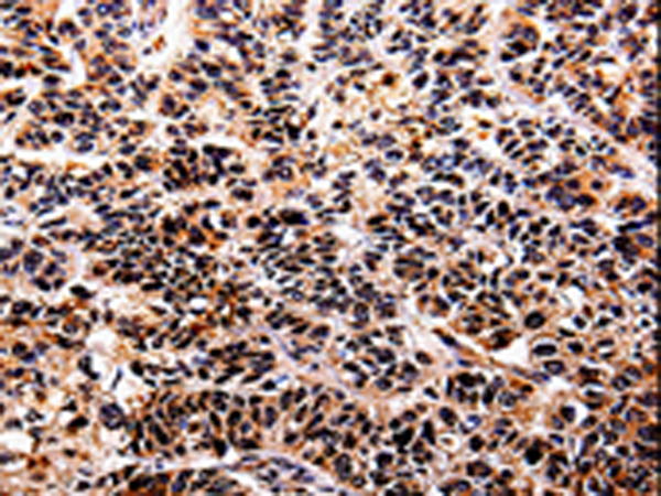 Rabbit Polyclonal Antibody to IL10RA