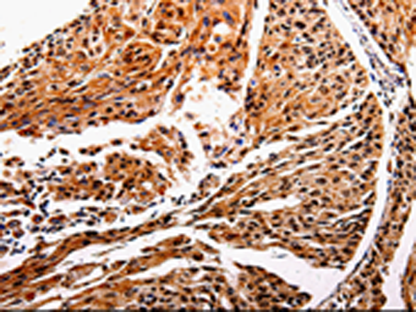 Rabbit Polyclonal Antibody to IL10RB