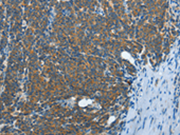 Rabbit Polyclonal Antibody to IL13RA2