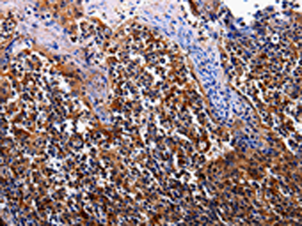 Rabbit Polyclonal Antibody to IL17RC