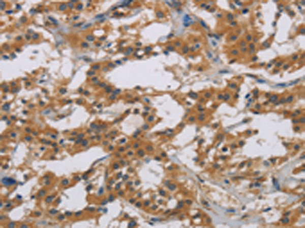 Rabbit Polyclonal Antibody to IL18R1