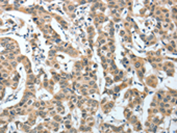 Rabbit Polyclonal Antibody to IL1R1