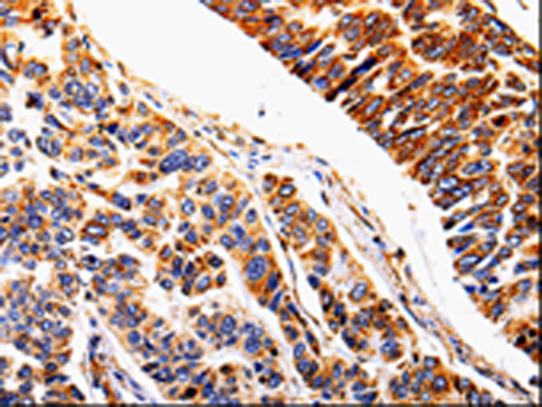 Rabbit Polyclonal Antibody to IL1R2