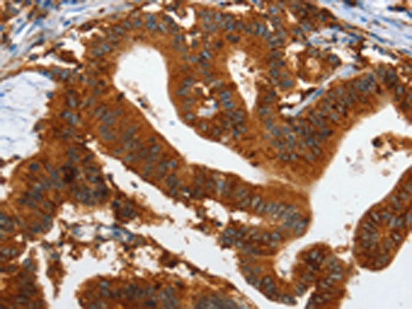 Rabbit Polyclonal Antibody to IL20RA