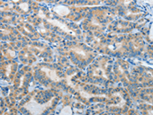 Rabbit Polyclonal Antibody to IL21R