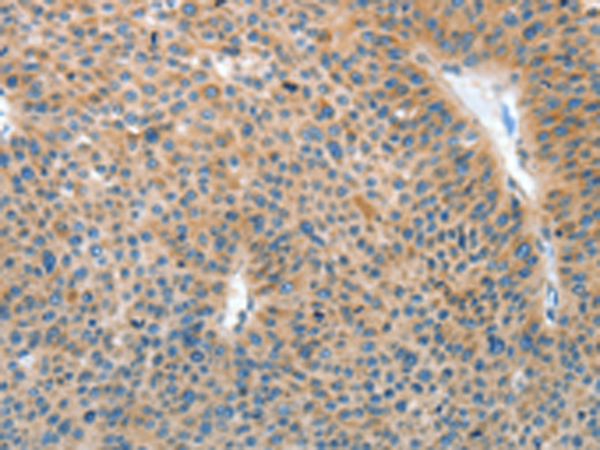 Rabbit Polyclonal Antibody to IL22RA1