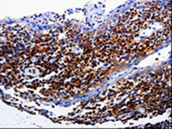 Rabbit Polyclonal Antibody to IL31RA