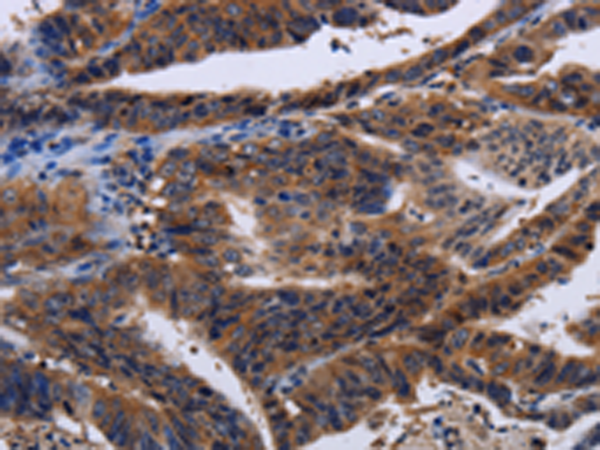 Rabbit Polyclonal Antibody to HTR2B