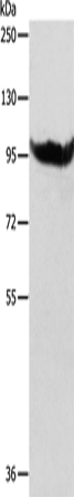 Rabbit Polyclonal Antibody to AARS2