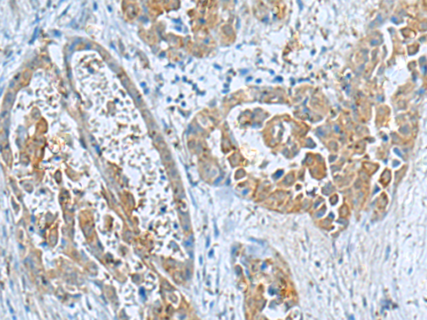 Rabbit Polyclonal Antibody to ABCB5