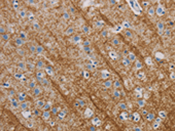 Rabbit Polyclonal Antibody to ABL1