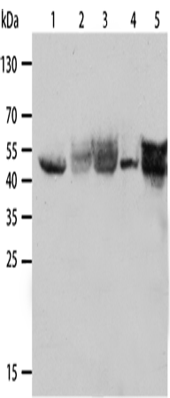 Rabbit Polyclonal Antibody to KRT19