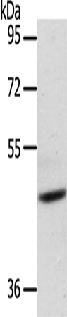 Rabbit Polyclonal Antibody to ADIPOR1