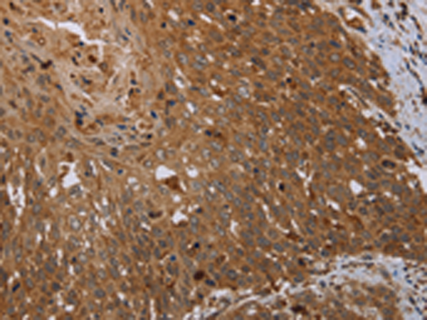 Rabbit Polyclonal Antibody to AIFM1