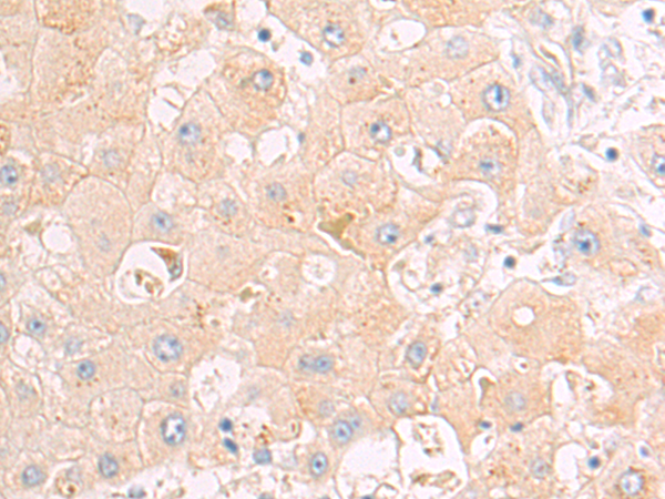 Rabbit Polyclonal Antibody to AK1