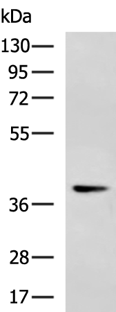 Rabbit Polyclonal Antibody to ALDOA