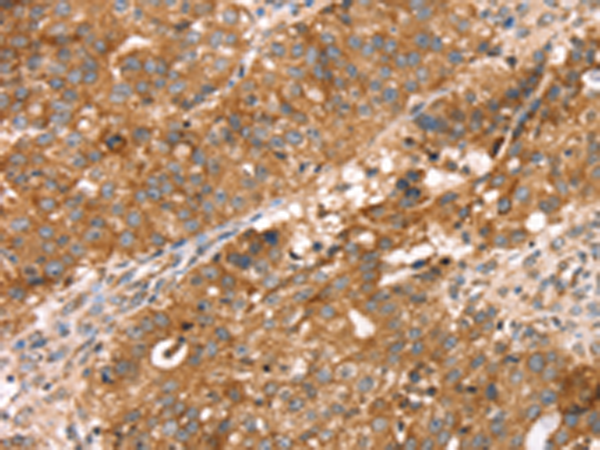 Rabbit Polyclonal Antibody to GFER