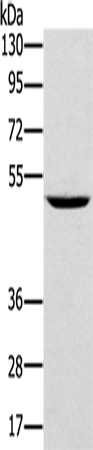 Rabbit Polyclonal Antibody to AMACR