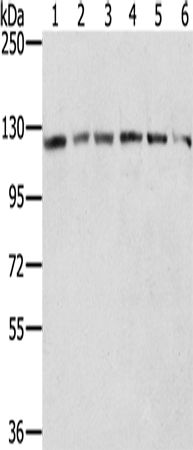Rabbit Polyclonal Antibody to AMPH